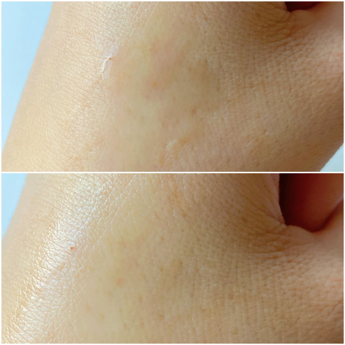 ザクロビタミンC美白アンプル/NATURAL DERMA PROJECT/美容液を使ったクチコミ(6枚目)