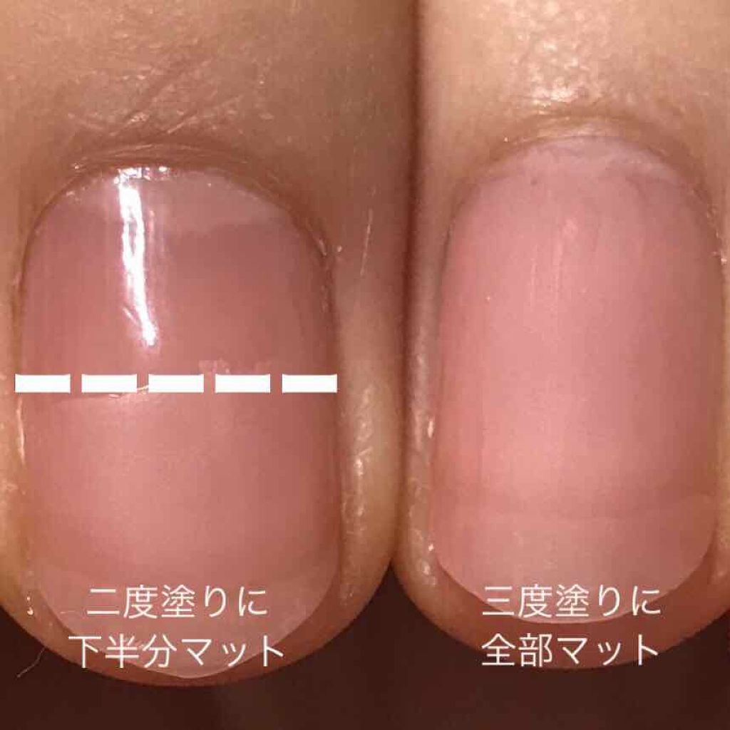 エルファー ネイルキッスB/DAISO/除光液を使ったクチコミ（3枚目）