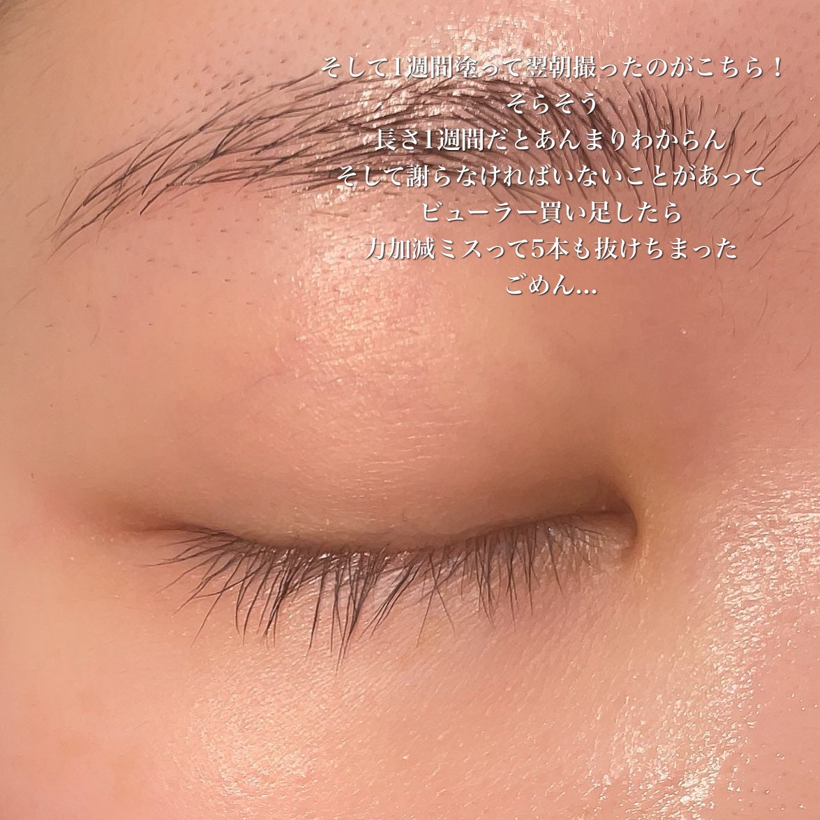 FEG Eyelash Enhancer/FEG/まつげ美容液を使ったクチコミ(3枚目)