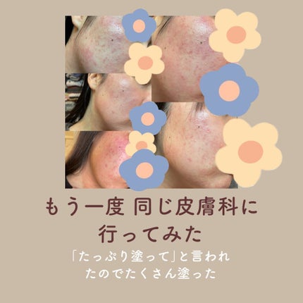 100日後に垢抜けたい女 on LIPS 「【皮膚科やめた話】こんにちは。「100日後に垢抜けたい女」です..」(4枚目)
