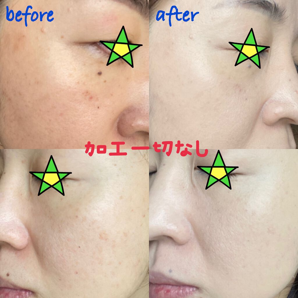 ネオクッション マット/LANEIGE/クッションファンデーションを使ったクチコミ(4枚目)