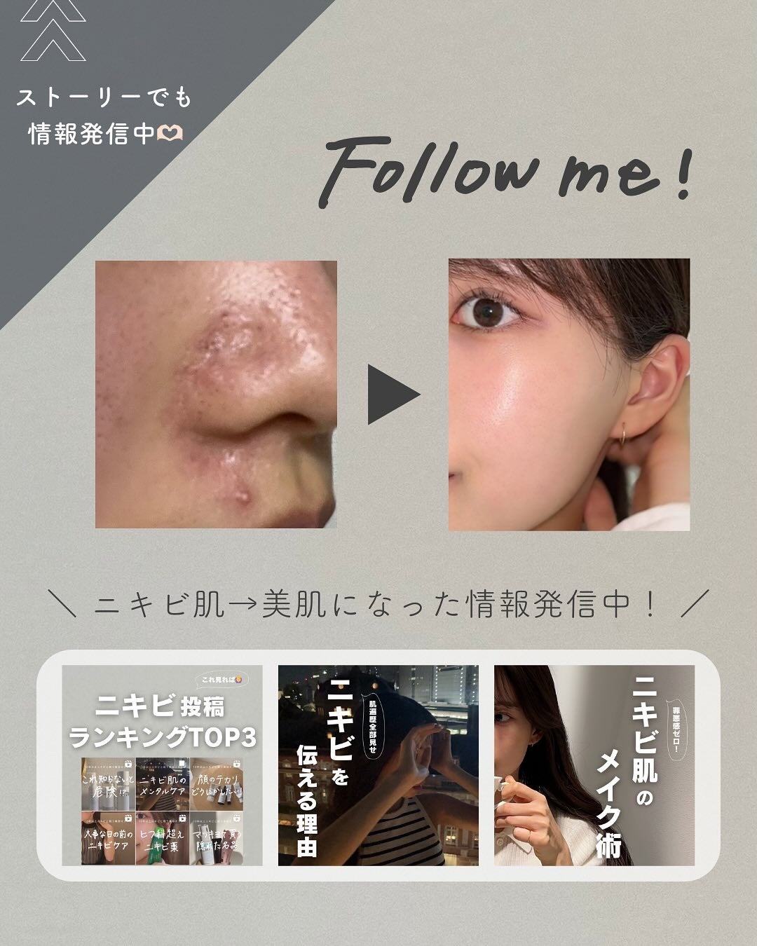 白湯(サユ) | ニキビと戦うOL🤍 on LIPS 「.白湯です!最近ちらほら花粉悩みのDMが届いてたから敏感肌さん..」(8枚目)