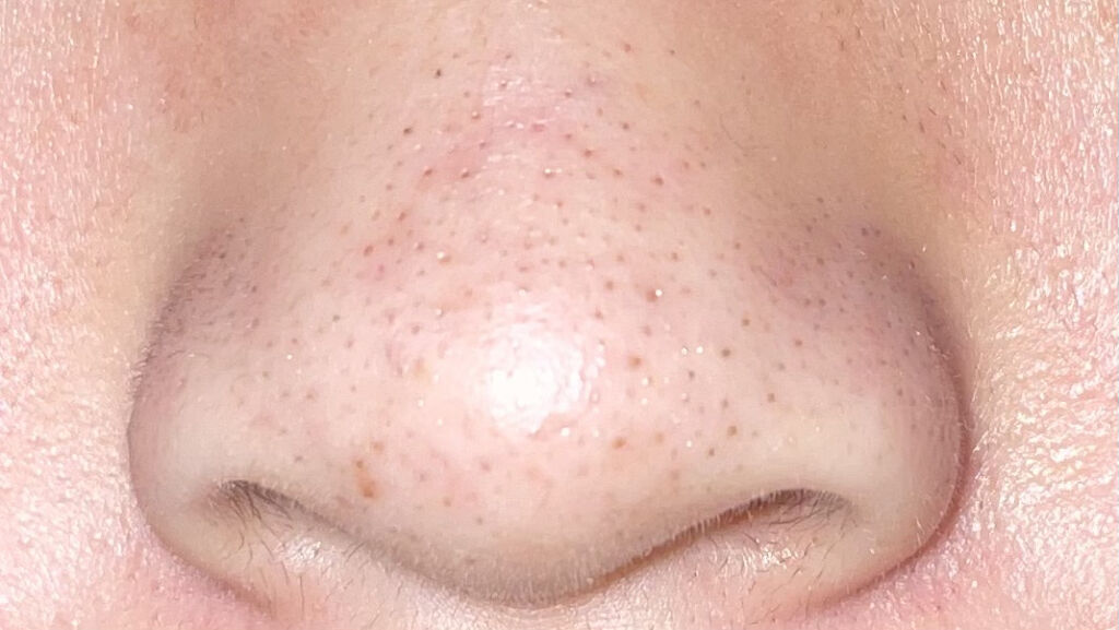 クレンジングバーム/ink./クレンジングバームを使ったクチコミ（1枚目）