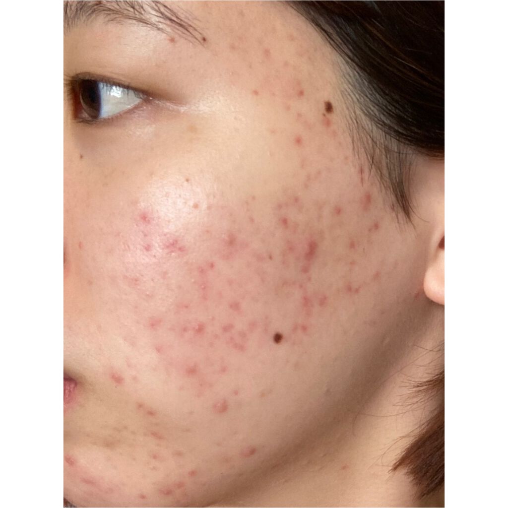 スイサイ ビューティクリア パウダーウォッシュ/suisai/洗顔パウダーを使ったクチコミ（1枚目）