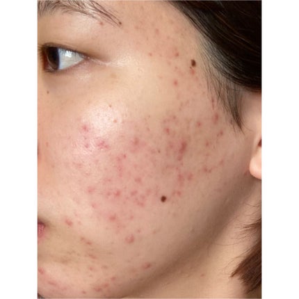 ディープクリア洗顔パウダー/ファンケル/洗顔パウダーを使ったクチコミ(1枚目)