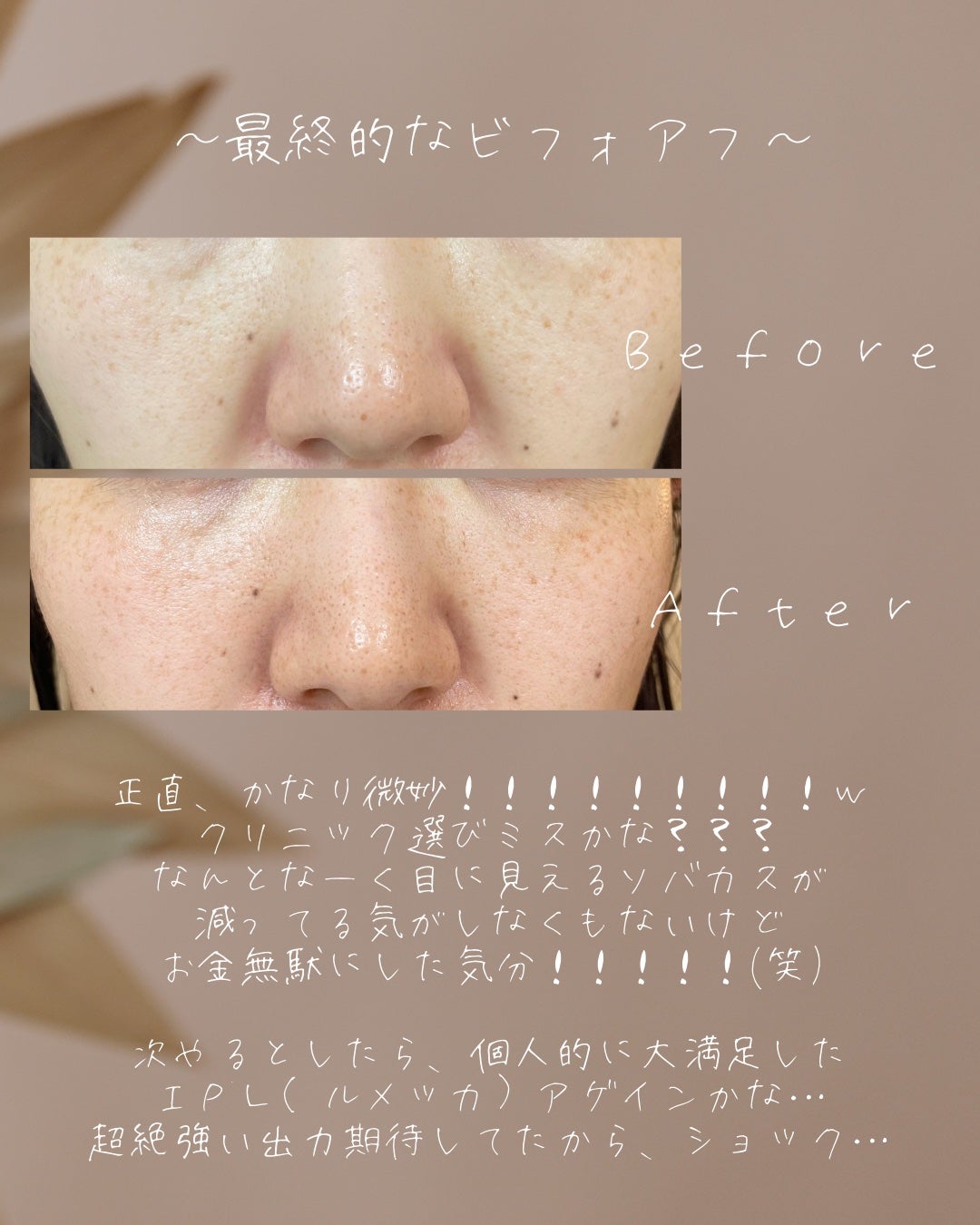 ããðª on LIPS ããã³ã¹ãããã®èšé²âïžðããããããã³ã¬ãŒã¶ãŒããšã¯ãã³ç§ïŒ1..ãïŒ5æç®ïŒ