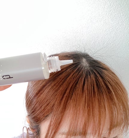 ヘアージュ 育毛剤 ヘアエッセンス/hairju/頭皮ローションを使ったクチコミ(6枚目)
