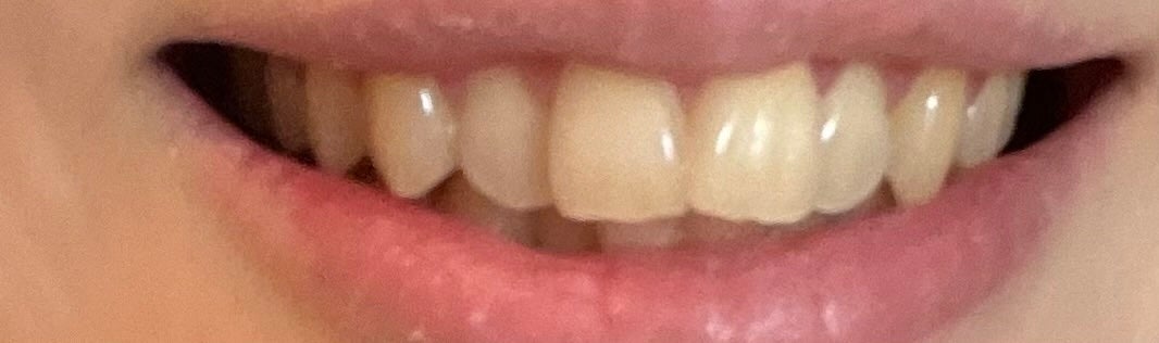 ホワイトニングパウダー ミント/Dr.Oral/歯磨き粉を使ったクチコミ(3枚目)