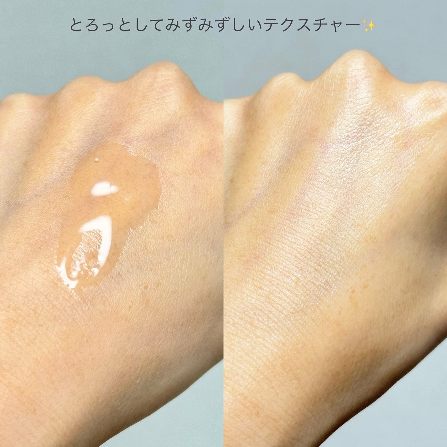 チャージマイセルフVトリートメントローション/MiMiTURE/化粧水を使ったクチコミ(3枚目)