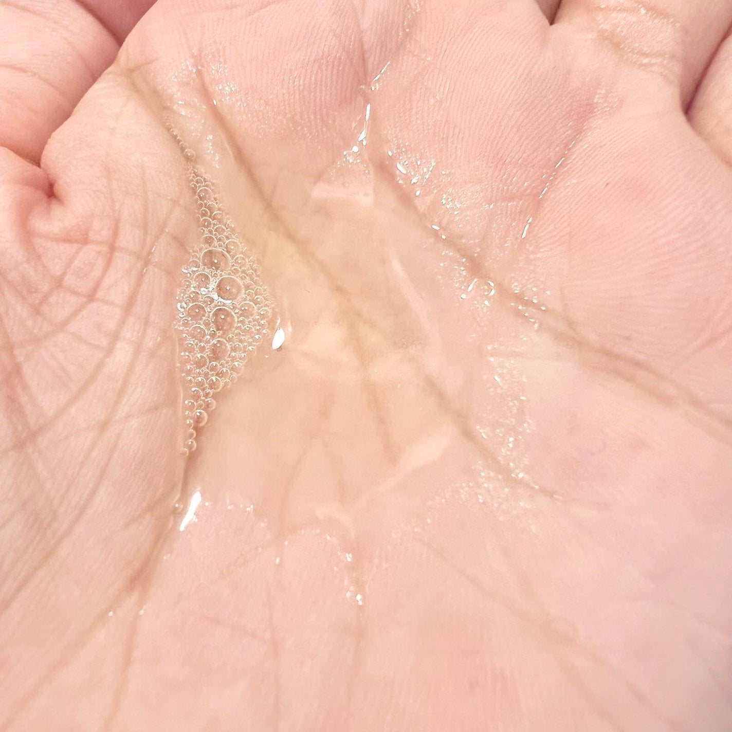 エンリッチ ローション/サイクルプラス/化粧水を使ったクチコミ(4枚目)