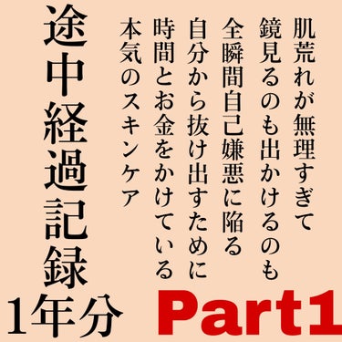 カルテHD バランスケア ローション/カルテHD/化粧水を使ったクチコミ（1枚目）