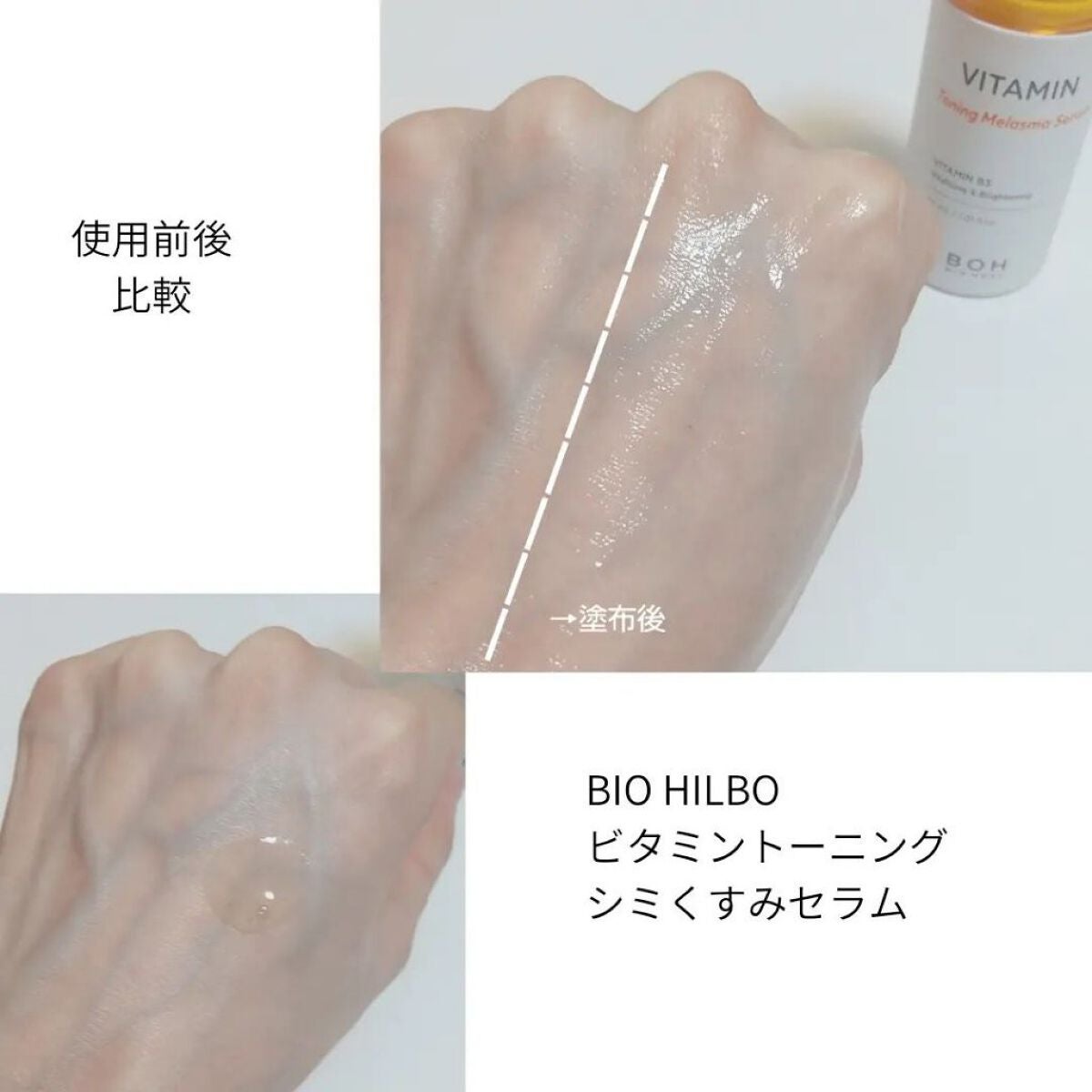 ビタミン ヒアルロニック ジェルクリーム/BIOHEAL BOH/オールインワン化粧品を使ったクチコミ(5枚目)