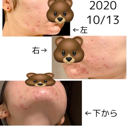 モイストリファイン 乳液 II しっとり/ファンケル/乳液を使ったクチコミ(2枚目)