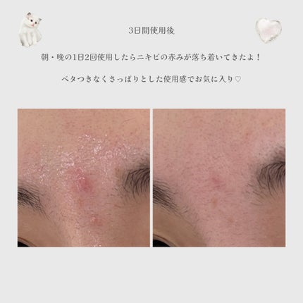 エクソソームシカセラム/MEDICUBE/美容液を使ったクチコミ(5枚目)