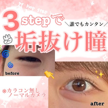 \私の白目が見えるまでの3️⃣step/

1.アイプチ
中学生からちゃんと癖つくようになるまで3年近くかかった🌀
やっぱりアイプチが1番大事だったけど瞼が伸びたいようにだけ気をつけて⛈️


2.瞼の