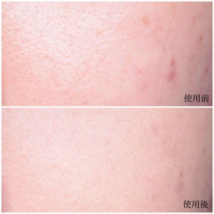 オリジナル ファンデーション(SPF15・PA++)/bareMinerals/パウダーファンデーションを使ったクチコミ(5枚目)