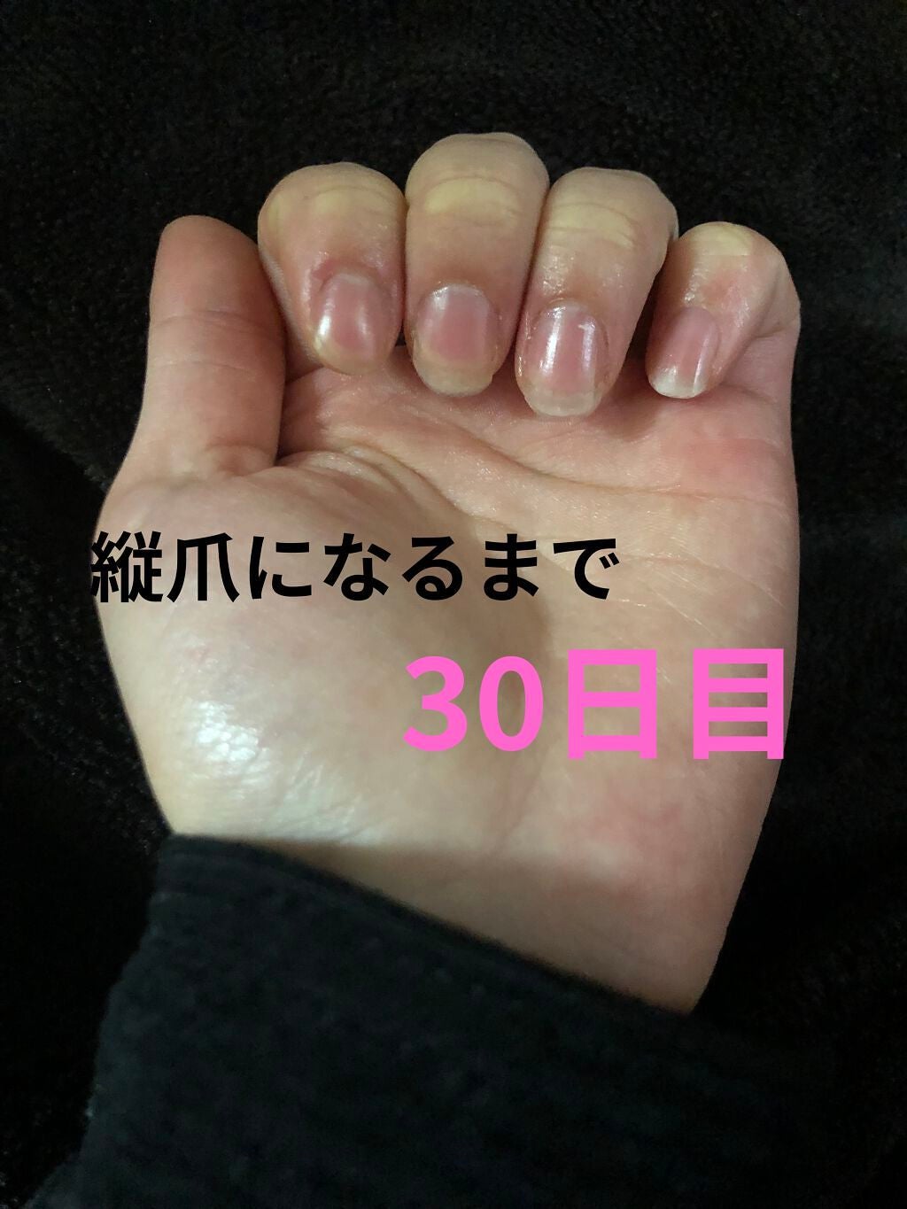 ð on LIPS ã瞊çªã«ãªãããã«ãããããªæ¹æ³ããã£ããæããŠãã ããð仿¥ã§..ãïŒ1æç®ïŒ