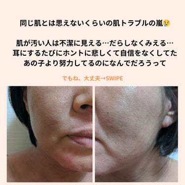 美肌カウンセラー💆綺麗のお助け相談所 on LIPS 「あなたはもっと綺麗になれる✨変わらない肌はなく、変われない肌は..」（3枚目）