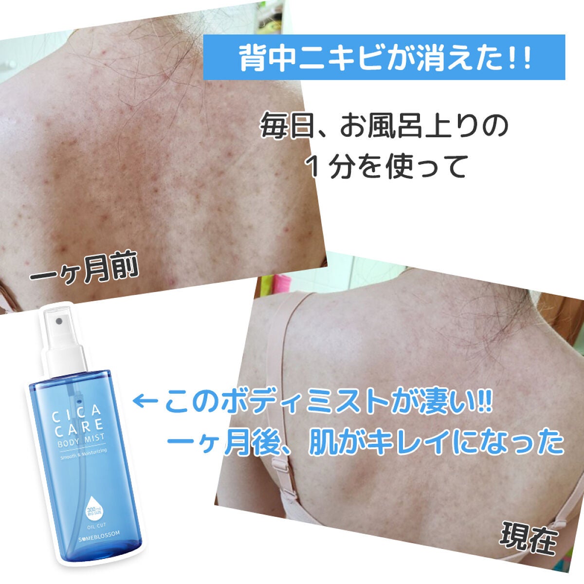 CICAケア ボディミスト/someblossom/ミスト状化粧水を使ったクチコミ(1枚目)