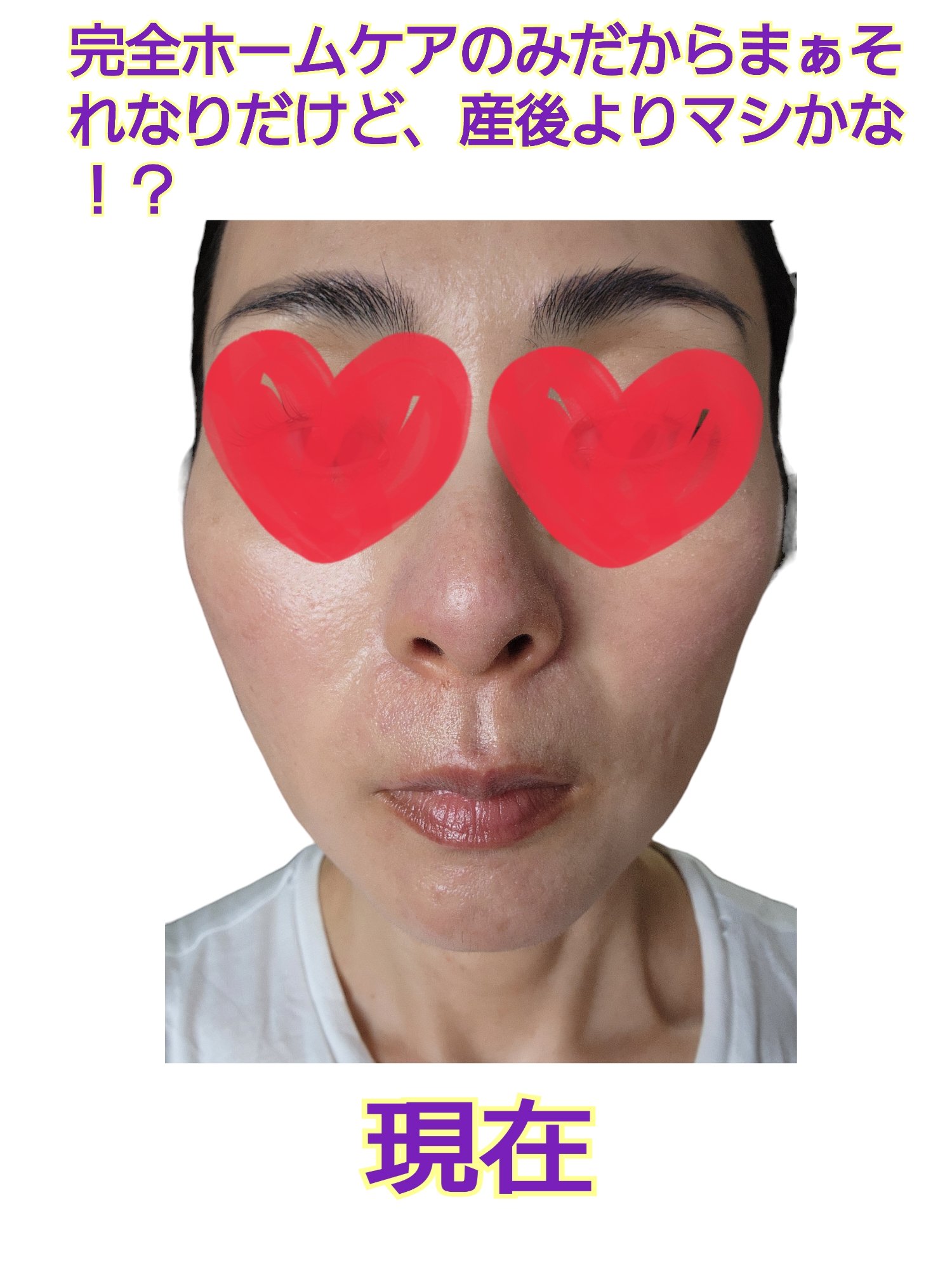 ビタC　グリーンティーエンザイム　ブライト　セラム/innisfree/美容液を使ったクチコミ（3枚目）