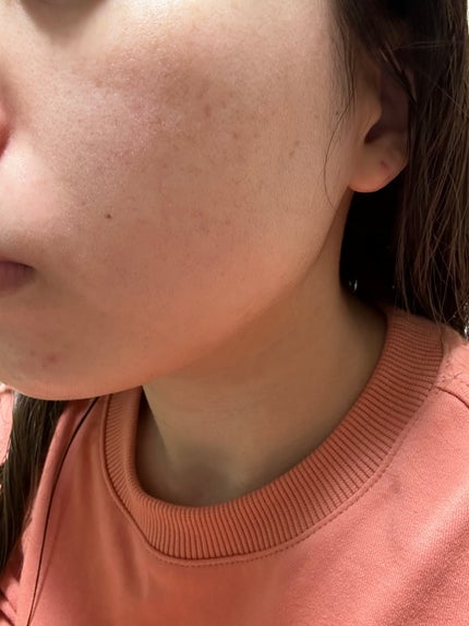 ディープブラック アクアモイスチャー シートマスク/ALFACE+/シートマスク・パックを使ったクチコミ(4枚目)