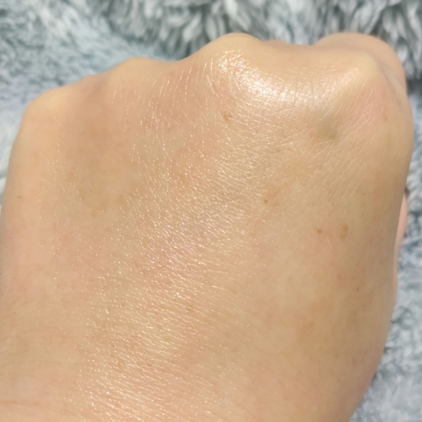 セルフホワイトニング ミッション/ALBION/美容液を使ったクチコミ(9枚目)