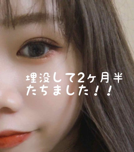 二重整形/その他を使ったクチコミ(1枚目)