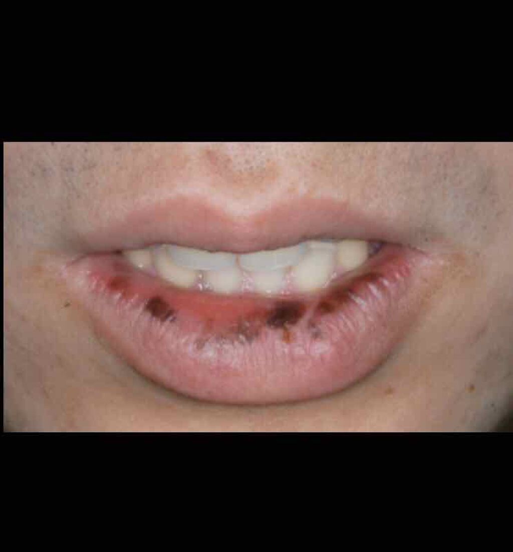 眠れる森の悪女💋 on LIPS 「こんにちは☺️ハルカです‼️一度、別のアカウントでやっていたの..」(4枚目)