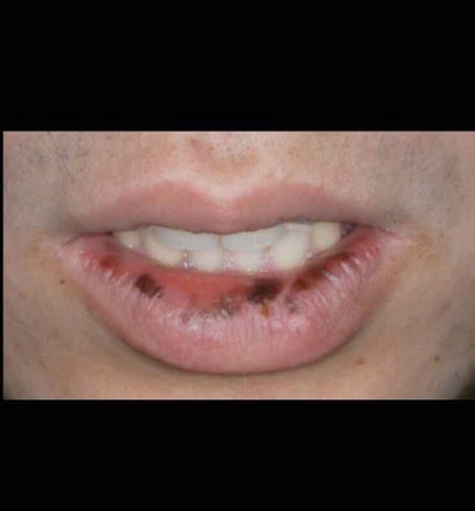 眠れる森の悪女💋 on LIPS 「こんにちは☺️ハルカです‼️一度、別のアカウントでやっていたの..」(4枚目)