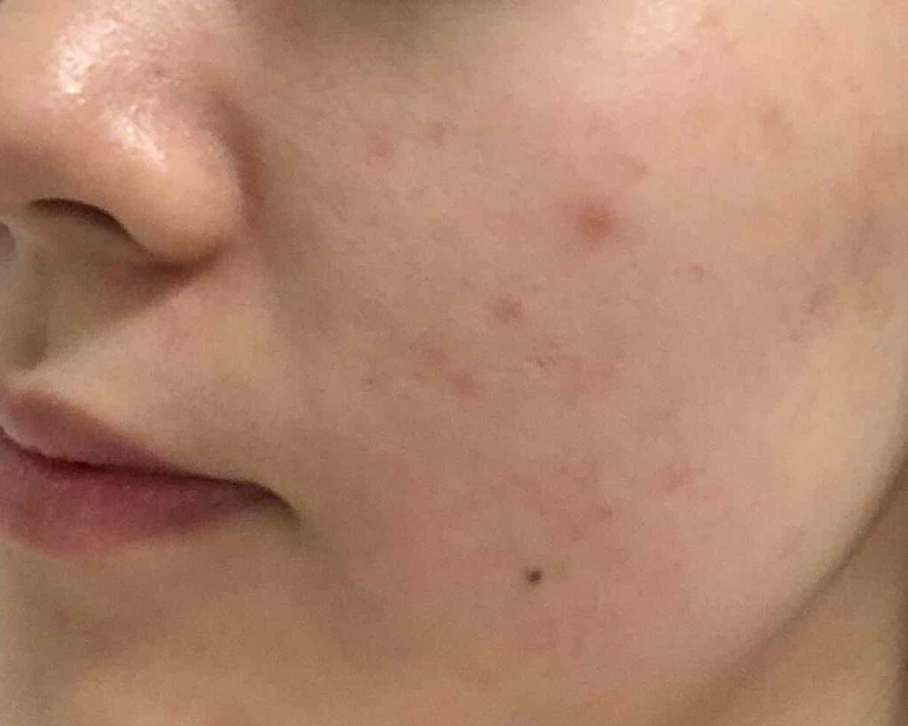 デュオ ザ クレンジングバーム/DUO/クレンジングバームを使ったクチコミ(3枚目)