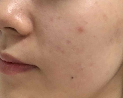 デュオ ザ クレンジングバーム/DUO/クレンジングバームを使ったクチコミ(3枚目)