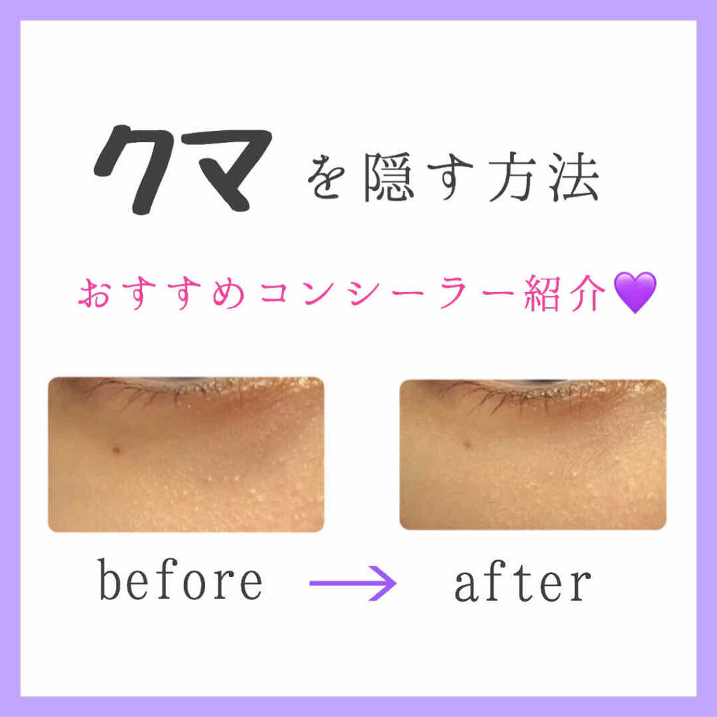 マジックコンシーラー/カリプソ/リキッドコンシーラーを使ったクチコミ（1枚目）