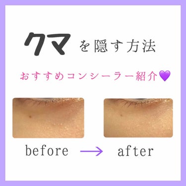 カバーパーフェクション チップコンシーラー/the SAEM/リキッドコンシーラーを使ったクチコミ（1枚目）