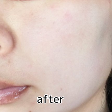 ヨナ フォロバ100 on LIPS 「PROMO様からステファニーサンブロックルーセントパウダーⅢ提..」(5枚目)