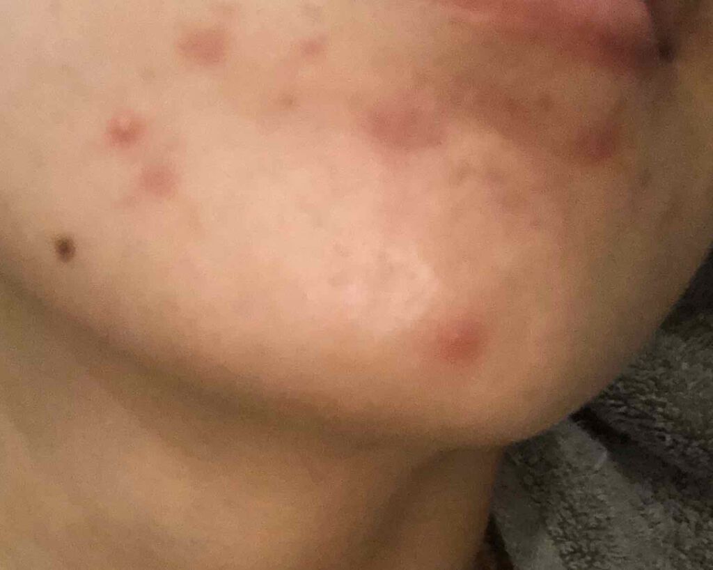 を使ったクチコミ（1枚目）