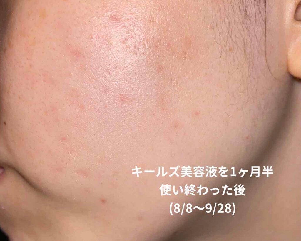 ジェニフィック アドバンスト N/LANCOME/美容液を使ったクチコミ(2枚目)