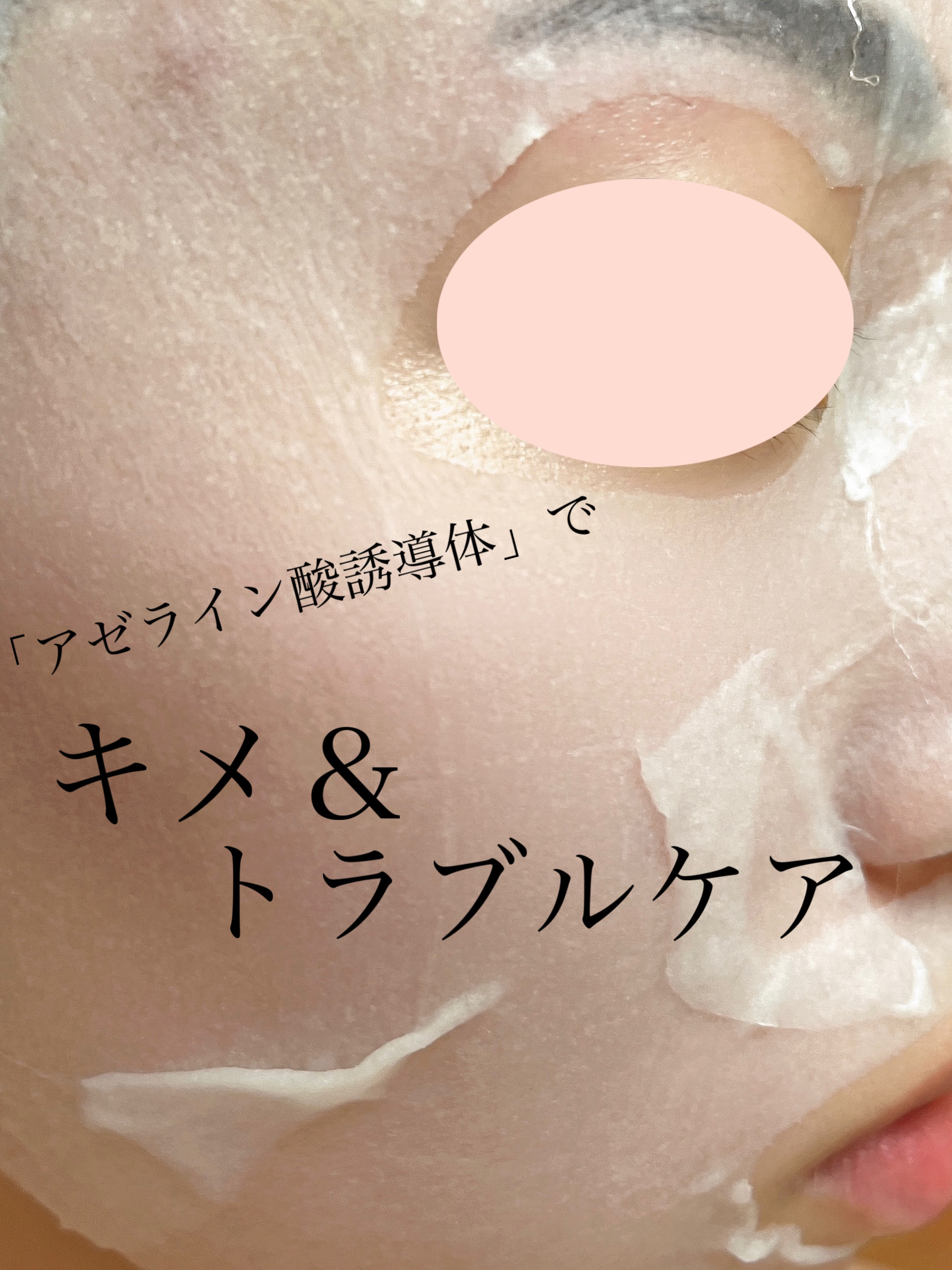 スージンググリーン スキニークリームマスク 30mL×1枚/ByUR/シートマスク・パックを使ったクチコミ（2枚目）