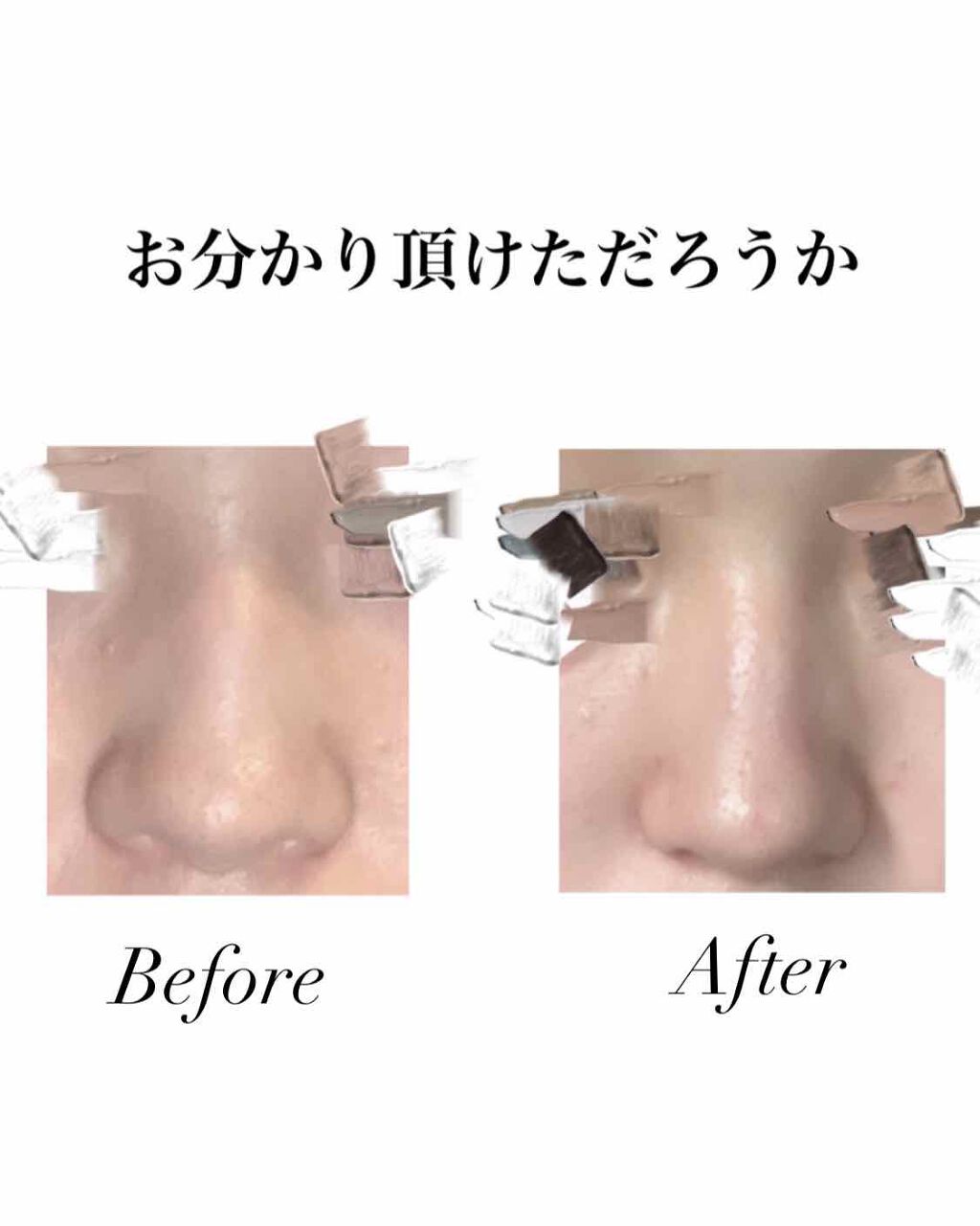 äœæ³å®€ðµ on LIPS ããåããé ããã ãããã錻çãéã£ãŠå°éŒ»ãå°ãããªã£ãŠããããš..ãïŒ1æç®ïŒ