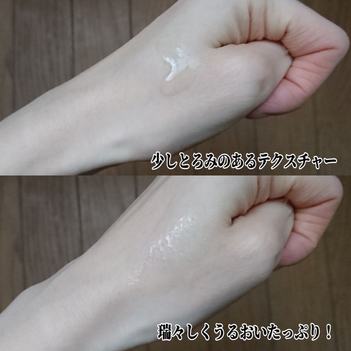 薬用育毛剤フエルダン/リムサプライ/頭皮ローションを使ったクチコミ（3枚目）