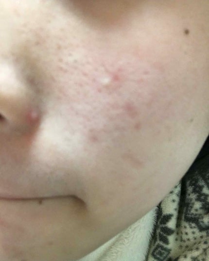 を使ったクチコミ(2枚目)