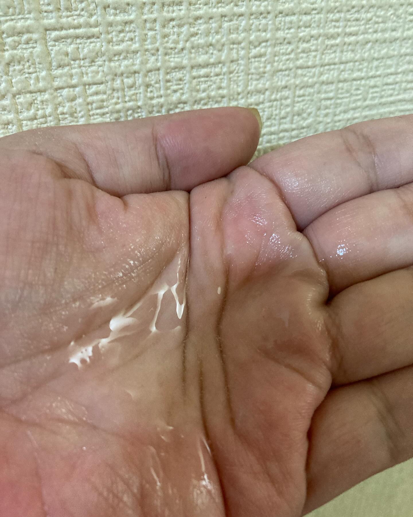 モエンアヌカチン頭皮アンプル/Dr.Viuum/頭皮ローションを使ったクチコミ（3枚目）