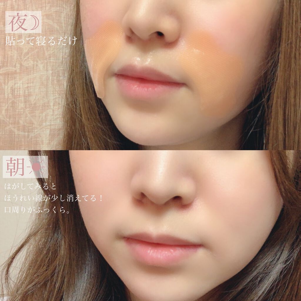 ダーマフィラースマイル/Quanis/シートマスク・パックを使ったクチコミ(5枚目)