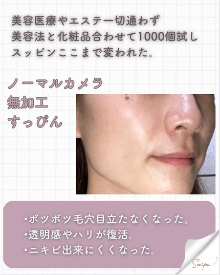 エッセンシャル トリートメントローション/ロベクチン/化粧水を使ったクチコミ(4枚目)