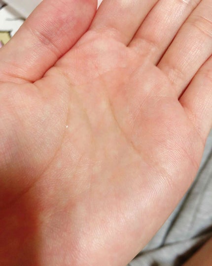 薬用しみ対策 美白化粧水/メラノCC/化粧水を使ったクチコミ(3枚目)