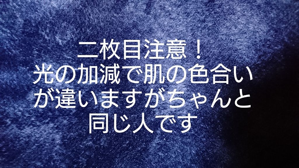 ビーソフテン ローション(医薬品)/持田製薬/その他を使ったクチコミ（1枚目）