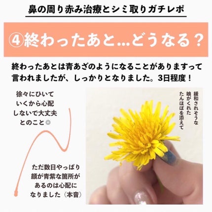 かおりんりん@16タイプパーソナルカラーアナリスト on LIPS 「『鼻の周り赤み治療とシミ取りガチレポ📝』あんまり大きな声で言..」(5枚目)