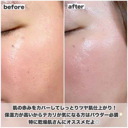 ヴェールヌーディ エッセンスパクトグロウ/AGE20’s/クリーム・エマルジョンファンデーションを使ったクチコミ(5枚目)