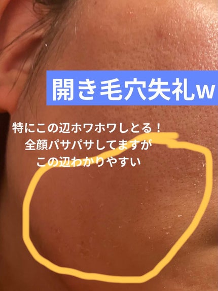 レチノールA 1% アドバンスドリバイタリゼーションクリーム/Life-flo/フェイスクリームを使ったクチコミ(2枚目)