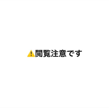 白色ワセリン(医薬品)/日本薬局方/その他を使ったクチコミ(1枚目)