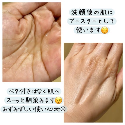 ジェニフィック アルティメ セラム/LANCOME/美容液を使ったクチコミ(3枚目)